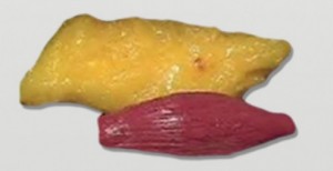 hnews-volume-massa-gorda-massa-muscular